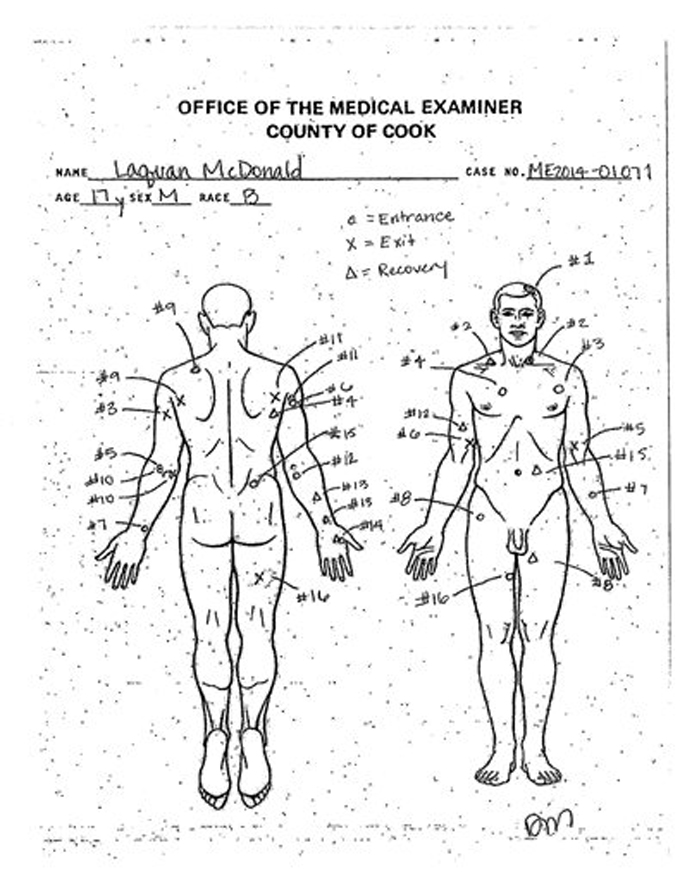 This undated autopsy diagram provided by the Cook County Medical Examiner's office shows the location of wounds on the body of 17-year-old Laquan McDonald who was shot by a Chicago Police officer 16 times in 2014. A judge on Thursday, Nov. 19, 2015 ordered the city to release squad car dashcam video of the shooting. The officer has been stripped of his police powers, but remains at work on desk duty. (Cook County Medical Examiner via AP)